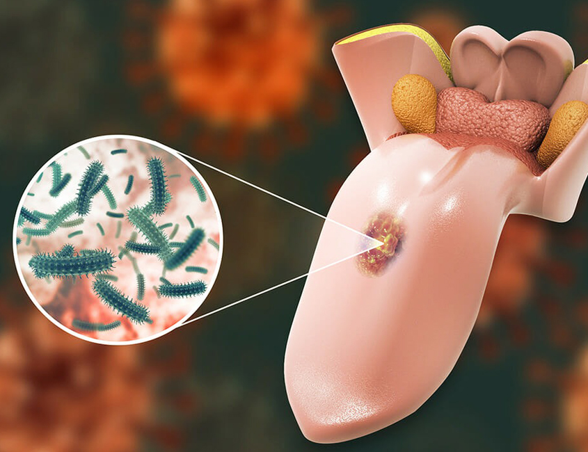 oral cancer screening elmhurst il