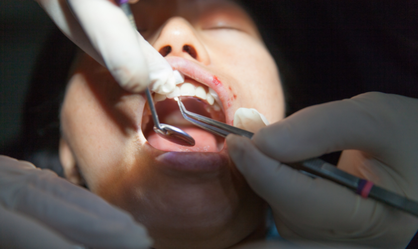 Oral Surgery