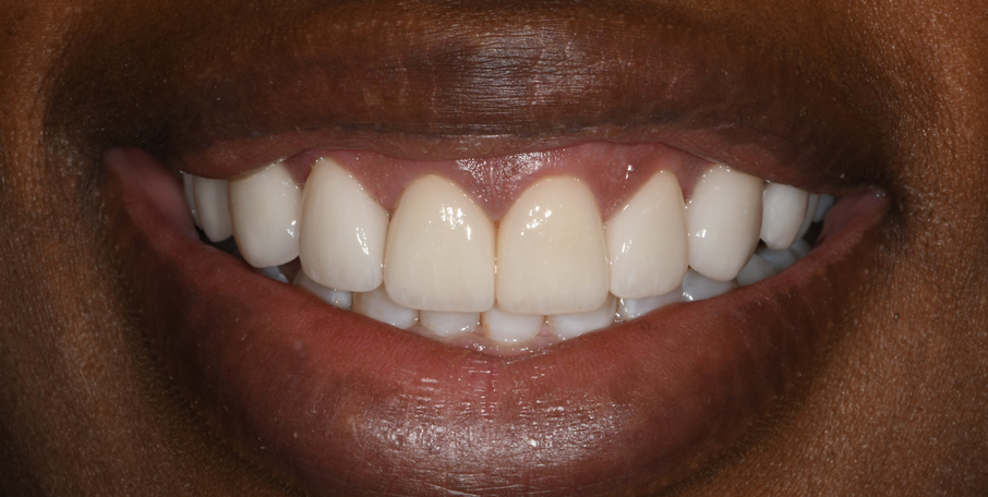 After Treatment 